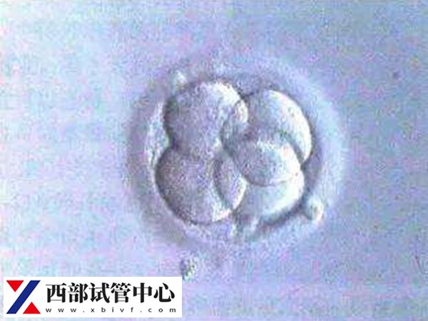 平衡易位會(huì)遺傳給后代